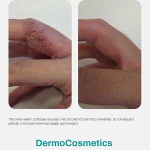 Nouvital Skin Relief Cream kremas sudirgusiai odai